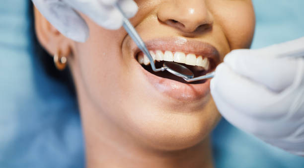 Best Emergency Dental Care for Sports Injuries in Old Greenwich, CT