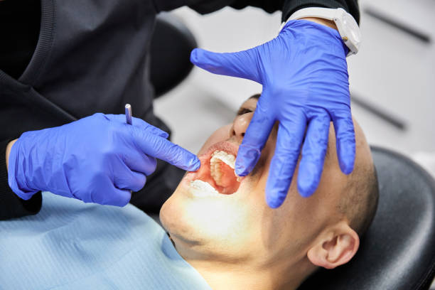 Best Emergency Root Canal Therapy in Old Greenwich, CT